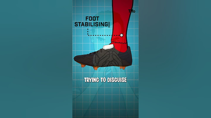 Why are footballers destroying their socks?