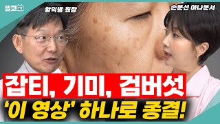 중년 피부 최대의 적!  '기미, 주근깨,검버섯'! 아주 깔끔하게  한 방에 해결해 드릴게요!!(함익병 +손문선) #피부 #잡티 #함익병 #손문선