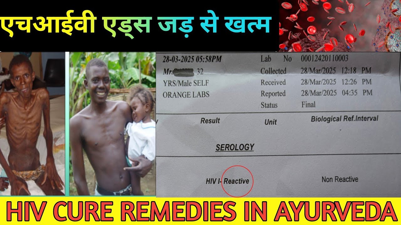 HIV AIDS NEGATIVE REPORT |  AYURVEDIC AUSHADHI COMPLETELY PERMANENT CURE HIV PATIENTS 