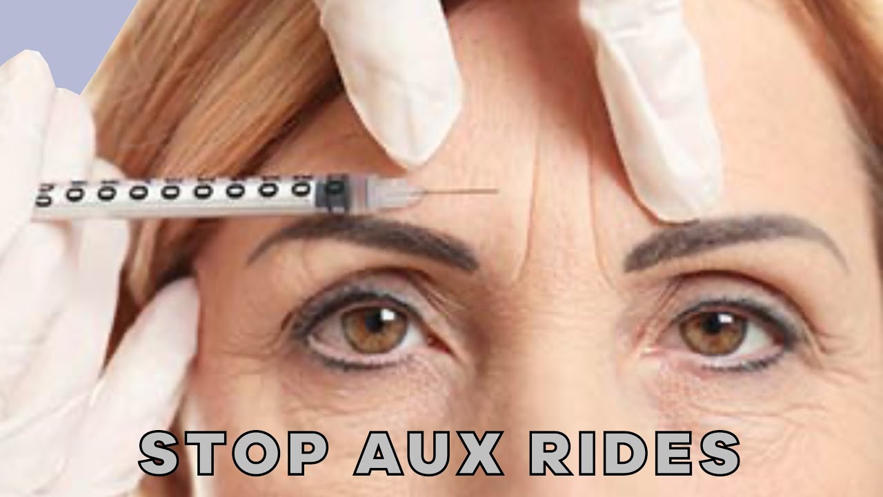 COMMENT FAIRE DISPARAITRE LES RIDES SANS CHIRURGIE À LA MAISON ? - YouTube