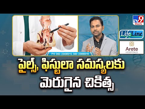Life line : పైల్స్, ఫిస్టులా సమస్యలకు మెరుగైన చికిత్స - TV9