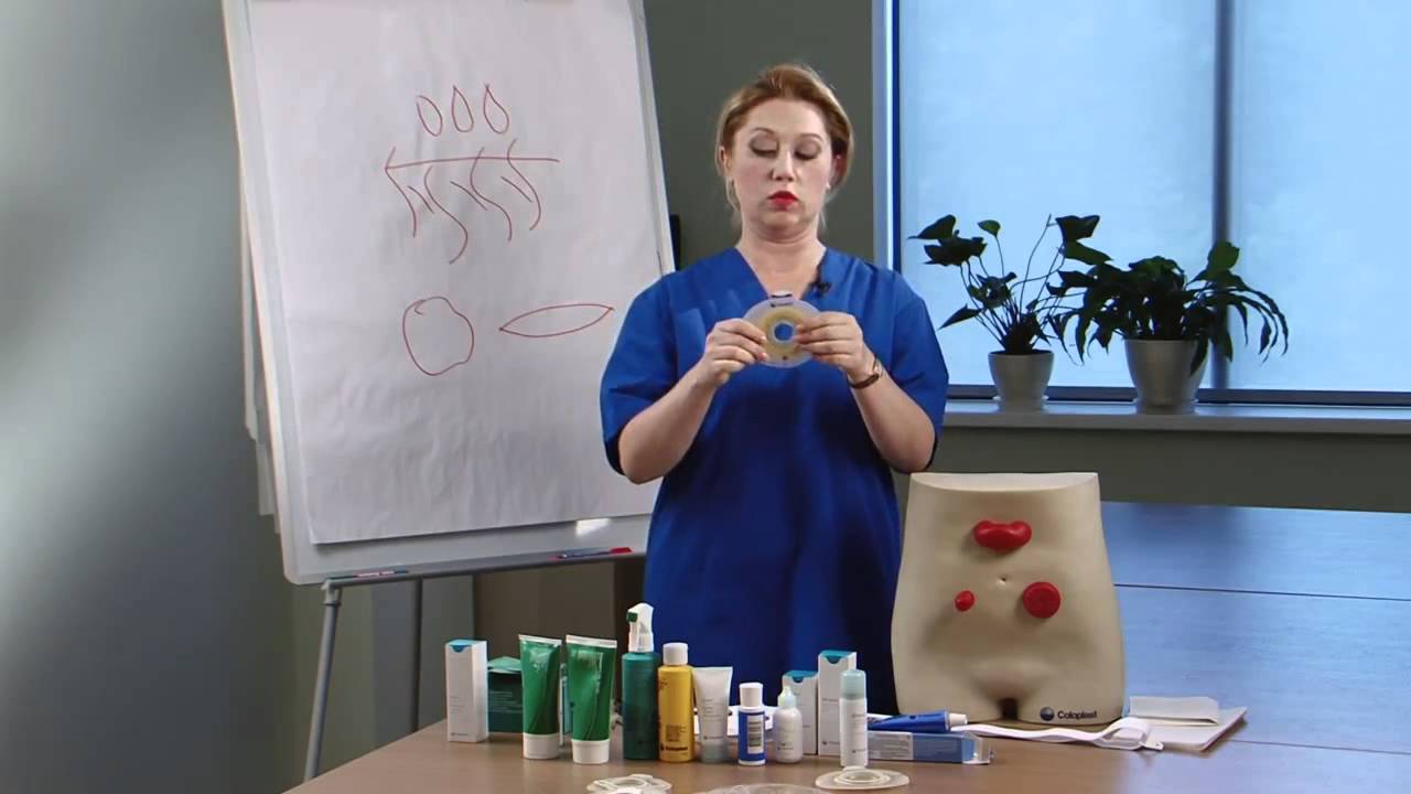 Уход за уростомой  Илеокондуит,операция по Брикеру