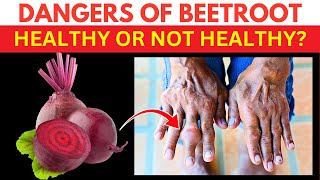 The Dark Side of Beetroot: 8 Shocking Side Effects (not what you think)