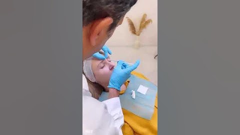 Precision Botox Injection for Frown Lines at EDEN AESTHETICS Clinic, Dubai