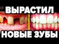 Выращивание новых зубов - 5 секретных техник о которых молчат стоматологи