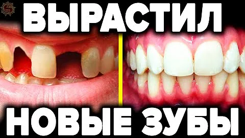 Выращивание новых зубов - 5 секретных техник о которых молчат стоматологи