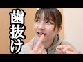 【ヤバい】歯が抜けました。