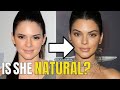 Kendall Jenner: Plastic Surgery