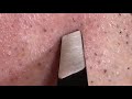 【pull out the beard】ずっと見てられる天国のヒゲ抜き 2018.5.16