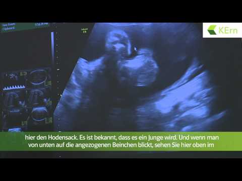 Video: 3 Möglichkeiten, Babys dazu zu bringen, mehr zu essen