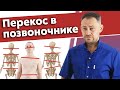 Что такое сколиоз позвоночника? / Какие последствия будут, если не лечить перекос позвоночника?