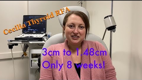 Thyroid RFA patinet Cecilia interview with  Sean Nikravan, MS