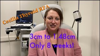 Thyroid RFA patinet Cecilia interview with  Sean Nikravan, MS