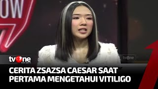 Cing Abdel Kedatangan Wanita Hebat yang Berhasil Bangun Dari Keterpurukan | tvOne