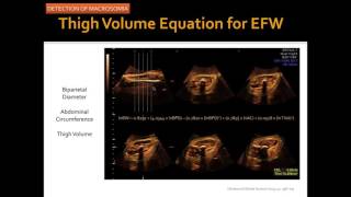 AIUM Webinar: Evaluating the Fetus at Risk for Shoulder Dystocia screenshot 2