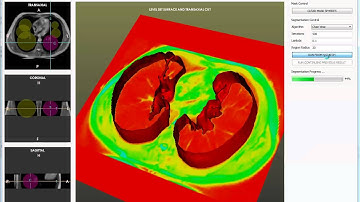 Interactive Level Set Segmentation