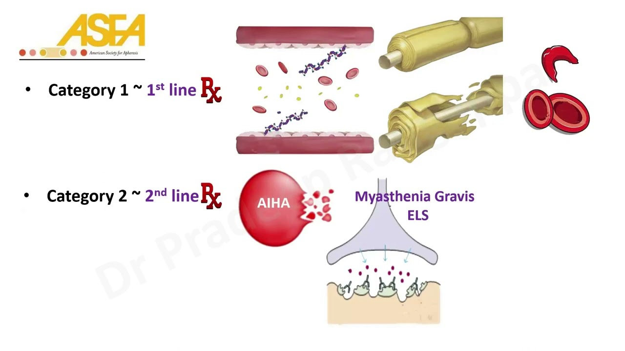 Plasmapharesis Overview_Indications, replacement fluid, regimes, complications