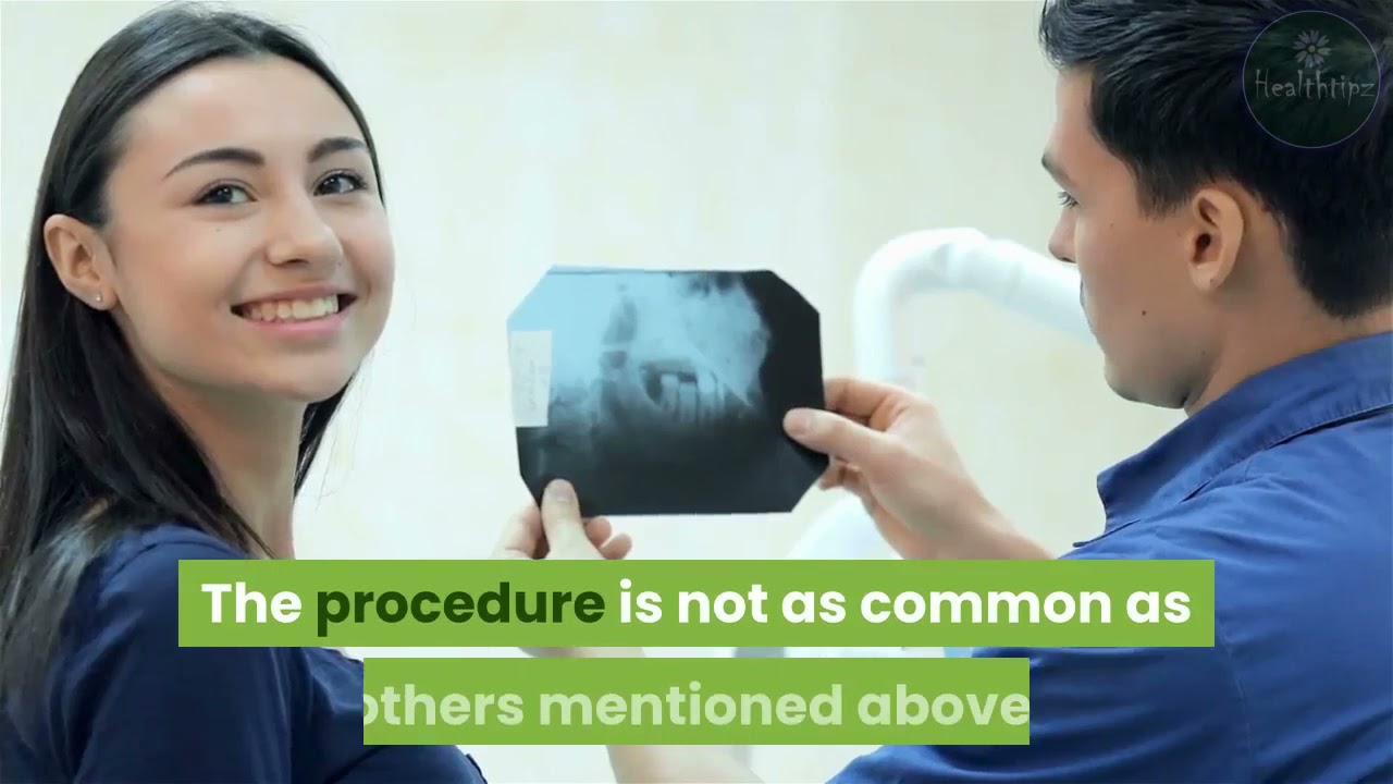 Acid Reflux and GERD Surgery Options YouTube