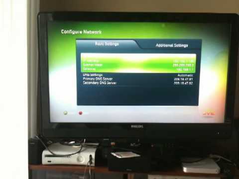 स्टेटिक आईपी एड्रेस प्राप्त करने के लिए अपने Xbox नेटवर्क सेटिंग्स को मैन्युअल रूप से कैसे कॉन्फ़िगर करें