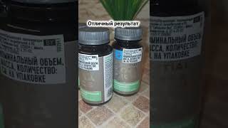 Болезнь Альцгеймера, Паркинсона, рассеянный склероз, деменция