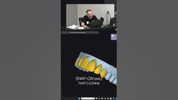 Adapt tool on Exocad! #aadentalondemand #digitaldentistry #exocad #exoplan