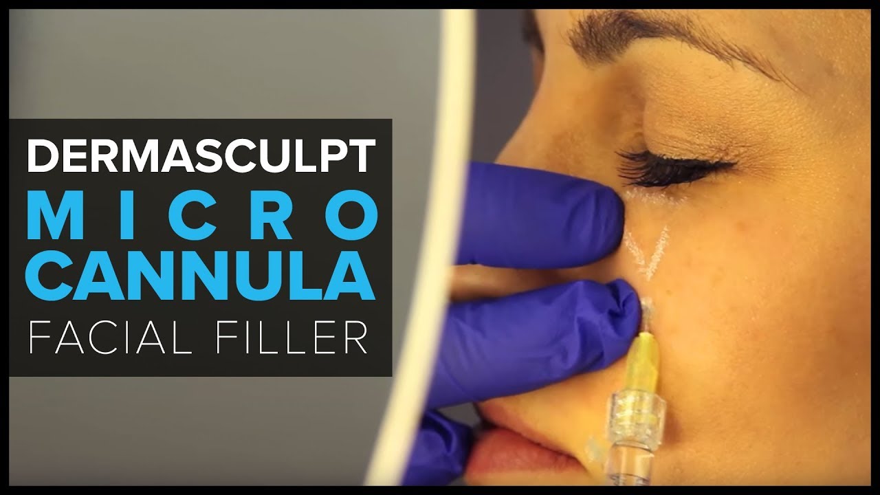DermaSculpt MicroCannula for Facial Filler Injections - YouTube