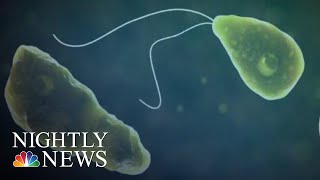 Brain-Eating Amoeba Kills Man Who Swam At Water Park NBC Nightly News