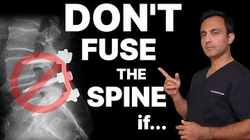 Wanneer u GEEN wervelkolomfusie nodig heeft
