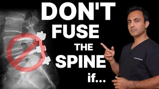 Quand vous n'avez PAS besoin d'une fusion vertébrale