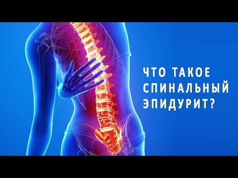 Что такое спинальный