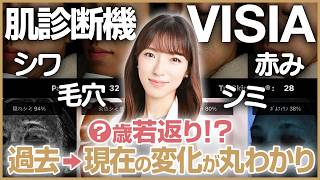 [VISIA Skin Diagnosis] Recommended before undergoing skin care treatment! The importance of knowi...