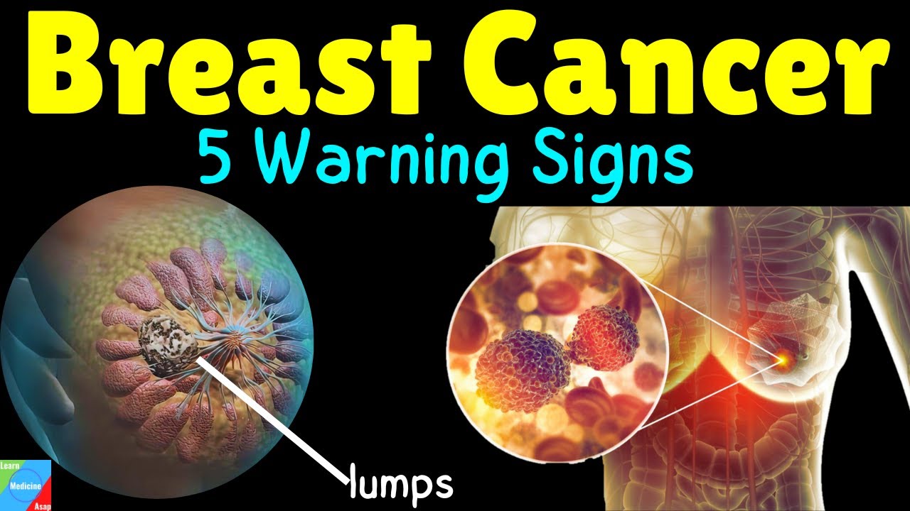 💗What are the 5 Warning Signs of Breast Cancer?  What are the Symptoms of Breast  Cancer? 