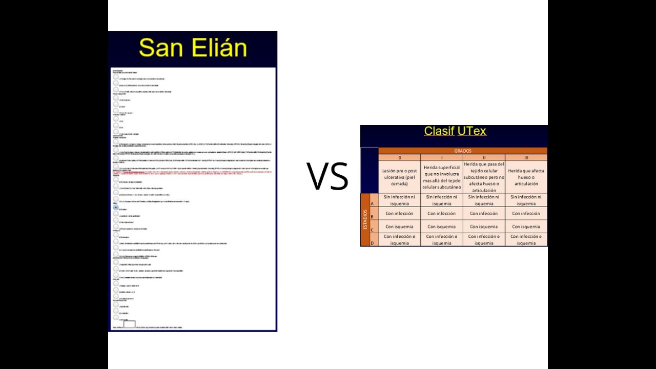La clasificación del pie diabético de San Elián no es tan santa. YouTube