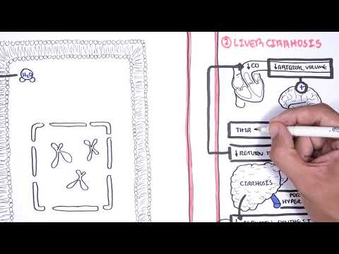 Hyponatraemia (Hyponatremia) - classification, causes, pathophysiology, treatment