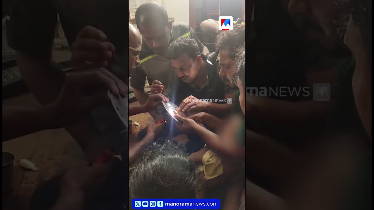 ചാലക്കുടിയിൽ ഒന്നര വയസുകാരിയുടെ  കൈ ഇഡലി തട്ടിന്‍റെ  ഉള്ളിൽ കുടുങ്ങി 