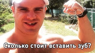 Сколько стоит вставить зуб? Сергей Романов ЖИВЬЁМ Сколько стоит вставить зуб? Сергей Романов ЖИВЬЁМ