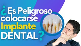 ¿Los Implantes Dentales SON PELIGROSOS?