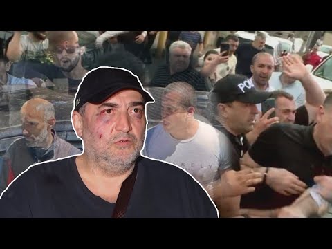 რატომ დახურა საგამოძიებო სამსახურმა მიშა მშვილდაძეზე თავდასხმის საქმე | რას აპირებს ჟურნალისტი