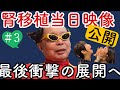 【No.3】夫婦で腎移植した日。貴重映像とともに振り返り。やはり気になるのは腎臓をくれた奥様の体調です