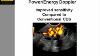 Color Doppler During Abdominal Ultrasound  Techniques, Applications and Pitfalls screenshot 1