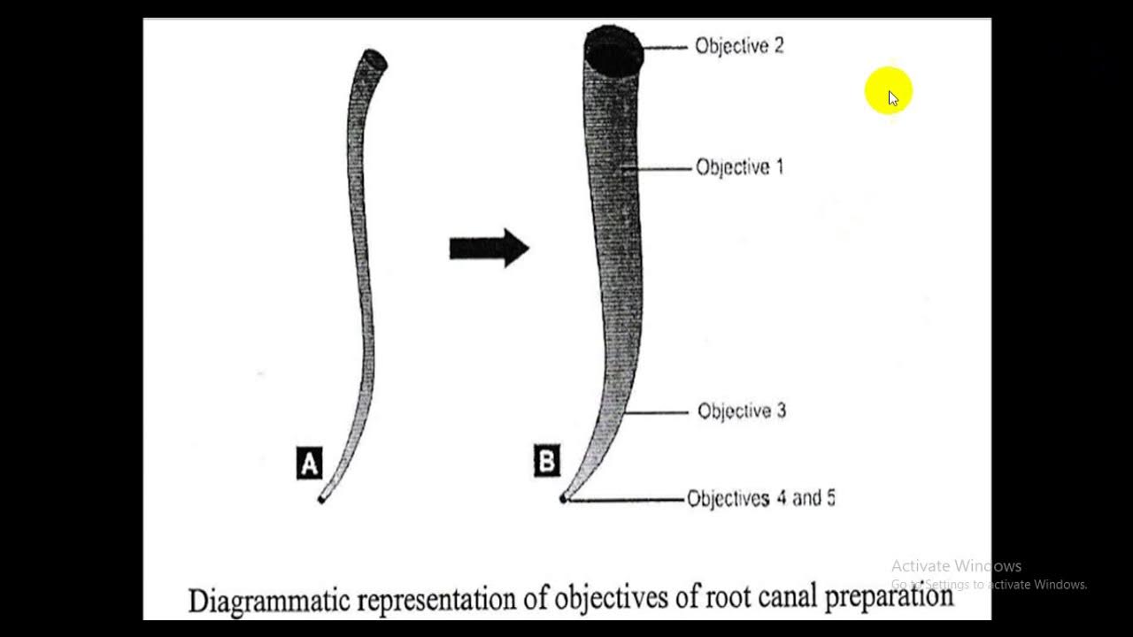 The mechanical objectives for successful root canal preparation given