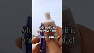 My Acne Is Gone In 2 Days. Its Benzac Ac Cream.