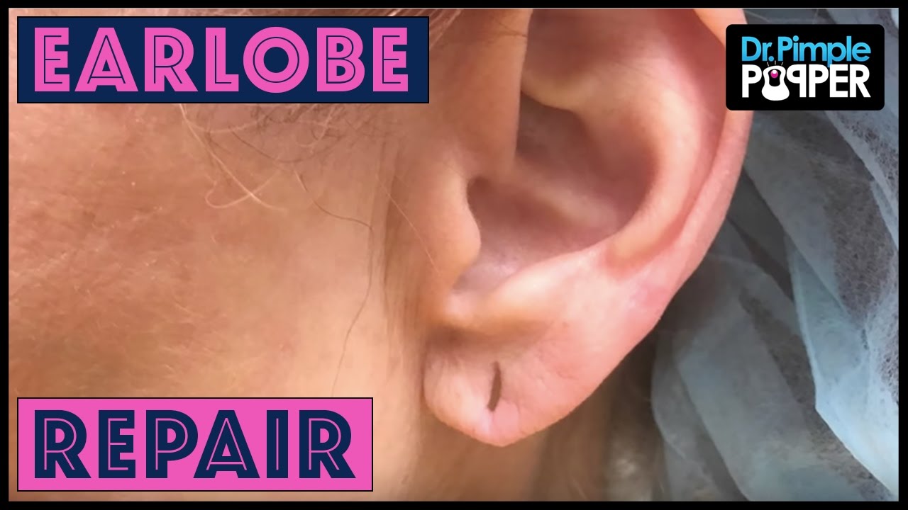 Earrings for Stretched Lobes: How to Rescue (Or Hide) Droopy