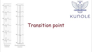 ECG basics (1.7). Transition point
