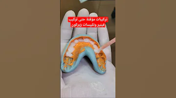 تركيبات مؤق تة بانتظار فينير الاسنان ايماكس وتلبيس الاسنان زيركون 