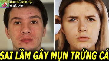 Nguyên nhân bị mụn trứng cá