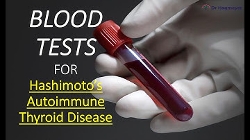 🧪How To Test for Hashimoto