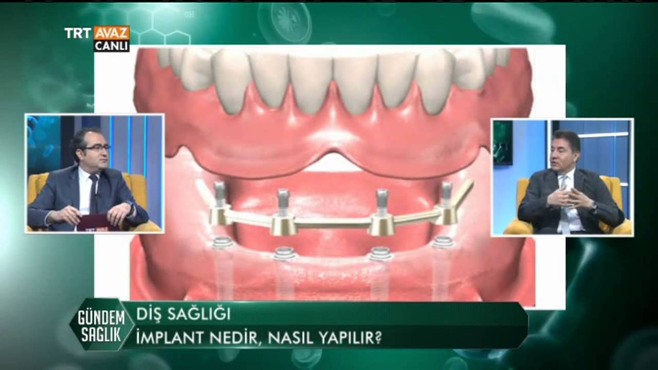 Gündem Sağlık (Diş Sağlığı/Ruhsal Hastalıklar) - TRT Avaz