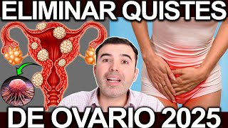 HOW TO CURE OVARIAN CYSTS 2025 - Eliminate Polycystic Ovary Syndrome HOW TO CURE OVARIAN CYSTS 2025 - Eliminate Polycystic Ovary Syndrome