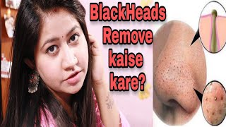 how to get rid of Blackheads and Whiteheads at Home | Blackheads Treatment || Tanushi and family